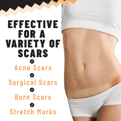 Silicone Scar Tape, Smoothing & Softening Silicone Gel Tape for Surgical Scars, Burns, Acne Marks & Minor Wounds, 4 cm × 1.5 m Roll